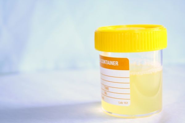 SetWidth600-urine-sample